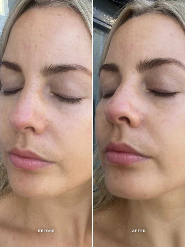 Alpha-H 維生素 E 精華液,含 1% 神經醯胺複合物 25ml