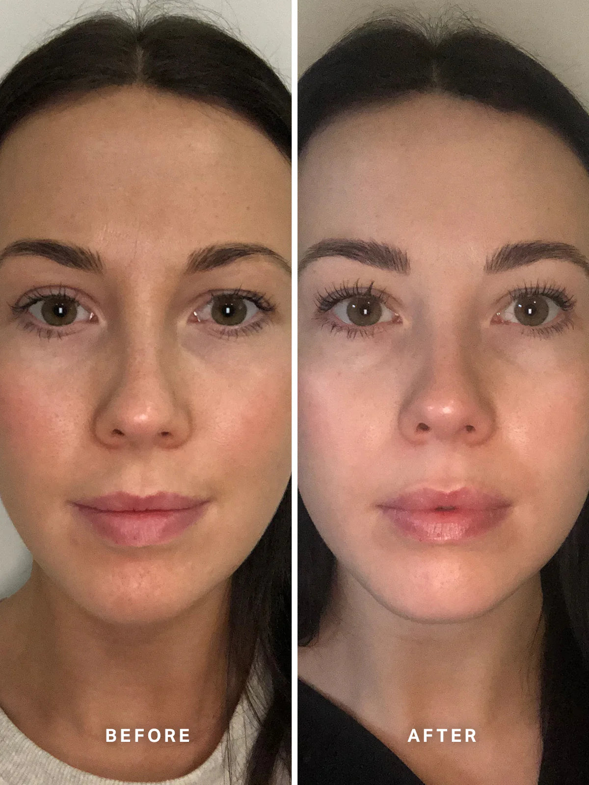 Alpha-H 維生素 B 精華液,含 5% 菸鹼醯胺 25ml